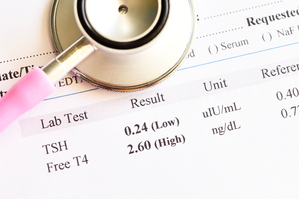 Abnormal thyroid hormone test result